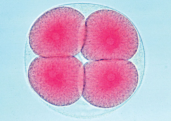 The Sea Urchin Embryology (Psammechinus miliaris)