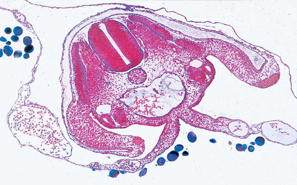 MP: The Chicken Embryology(Gallus domesticus)