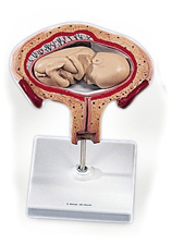 MOD: 4th Month Foetus, transverse lie