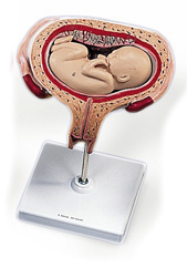 MOD: 5th Month Foetus, transverse lie