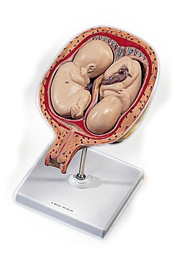 MOD: 5th Month Twin Foetuses, normal position